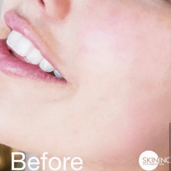 SKIN INC. ~ Serum Glow Filter Hydra Micro Capsule ~ 1 fl oz Full Size ~ New - Picture 6 of 9